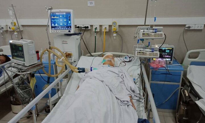 Nắng nóng gay gắt hoành hành miền Bắc, người phụ nữ tái phát bệnh cũ, chảy máu não hôn mê nguy kịch