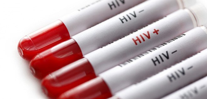 Vì sao số người nhiễm HIV ở Hà Nội, TP HCM tăng đột biến