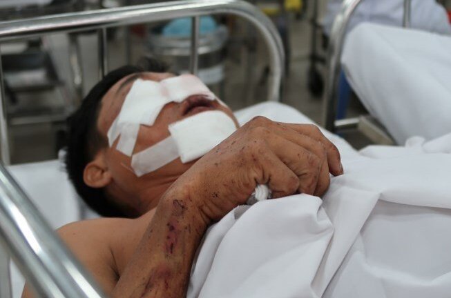 Lời kể của nạn nhân bị kẹp dính vào đầu xe sau tai nạn ở cao tốc Long Thành