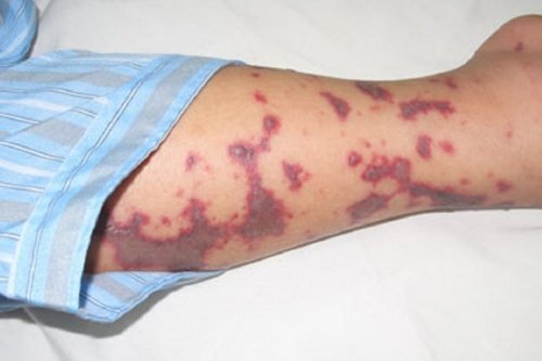 Lý do thiếu nữ 18 tuổi ở Hà Nội bất ngờ bị cách ly trong bệnh viện