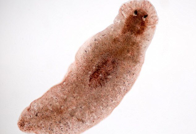 Rùng mình cảnh ký sinh trùng bơi trong mắt khiến một thanh niên bị mù