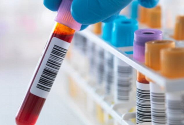 Ca nhiễm HIV được chữa khỏi thứ 3 trên thế giới