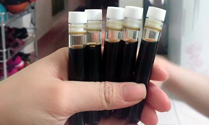 Lấy máu lươn trị mụn: Cách làm đẹp nguy hiểm, độc hại