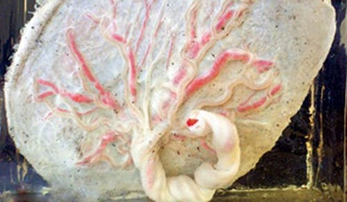 Thảm họa khôn lường khi sản phụ ăn tự ăn nhau thai của mình