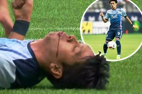Tại sao va chạm khi tranh bóng có thể khiến cầu thủ mất mạng