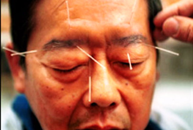 Mùa lạnh: Cảnh giác méo miệng, liệt mặt