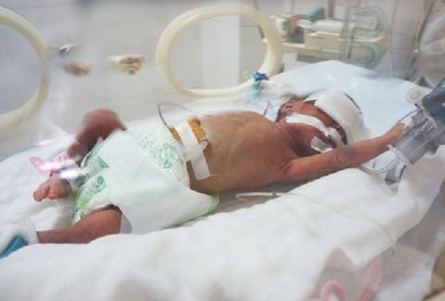 Tìm thấy vi khuẩn kháng thuốc ở ba bệnh nhi từng điều trị tại Bắc Ninh