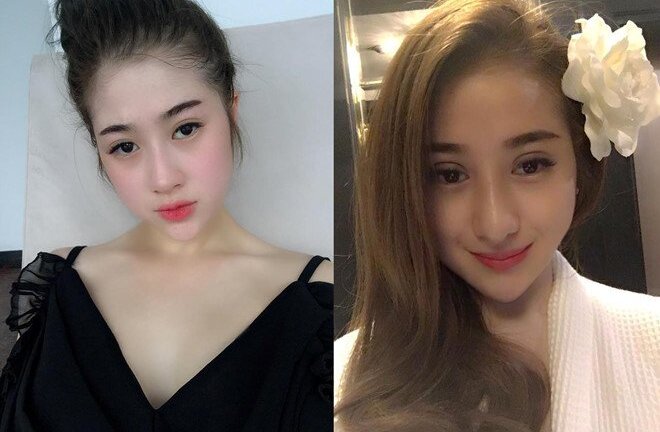 Bất chấp đau đớn của dao kéo, 5 cô gái Việt lột xác thành mỹ nữ