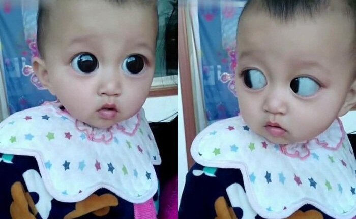 Ăn nhiều nho khi có thai, người phụ nữ choáng khi thấy con mình