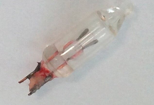 Bác sĩ phát hiện đèn trang trí trong phổi bé gái 14 tháng