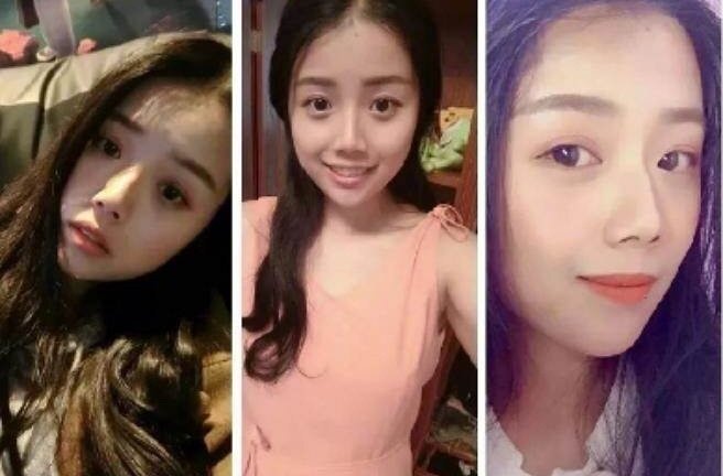 Sợ bệnh nhân chê cười, nữ y tá béo xấu xí lột xác ngoạn mục thành 'nữ thần'