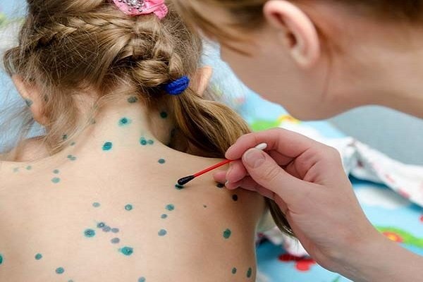Thời tiết lạnh, ẩm coi chừng nhiễm bệnh đáng sợ gây dị tật thai nhi