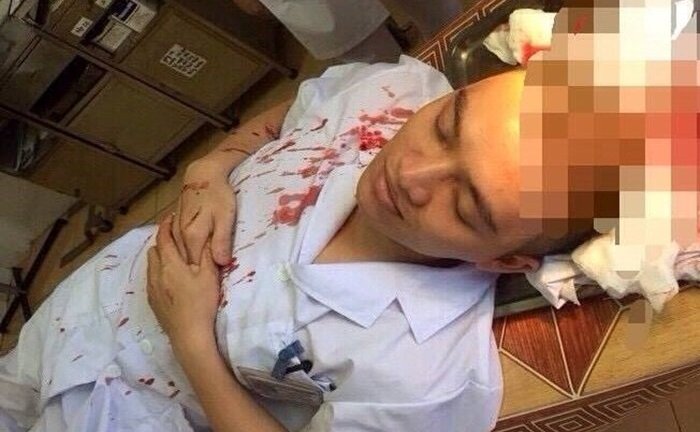Bác sĩ lại bị đánh, máu nhuộm đỏ áo blouse, ngày Thầy thuốc năm nay buồn đến thế!