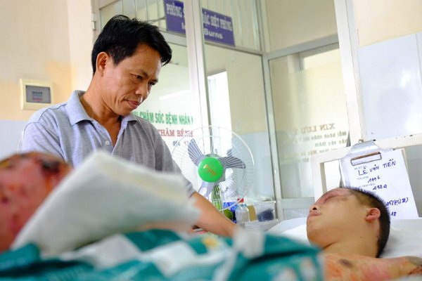 Ông bố tình nguyện hiến da để ghép cho con trai bị bỏng nặng