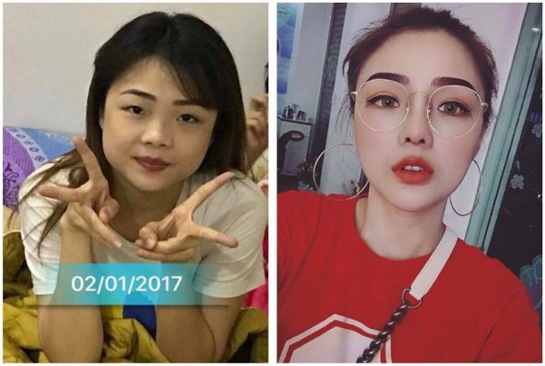 Cô gái Sài Gòn chỉnh sửa gương mặt khiến ông ngoại không nhận ra cháu