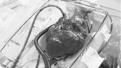 Hành trình đưa quả tim Thiếu tá quân đội vượt 1.600 km cứu chàng trai