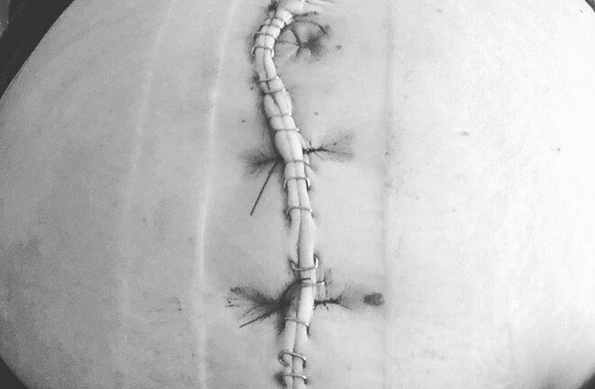 Xem những hình ảnh sinh mổ để thấy các bà mẹ đã trải qua đau đớn như thế nào