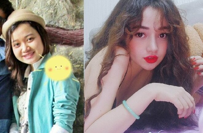 9X sở hữu gương mặt búp bê sau khi chi 100 triệu đồng 'dao kéo'