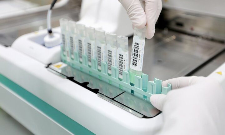 Gần 10 nghìn người dương tính với xét nghiệm tìm máu ẩn trong phân