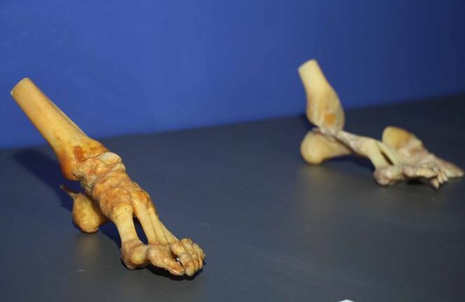 Tận thấy các mẫu vật rùng rợn, ám ảnh tại triển lãm xác người ở TPHCM