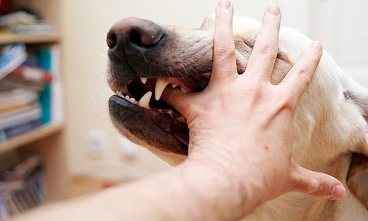 Lại thêm 2 người bị chó cắn đứt rời môi, lóc da bàn tay