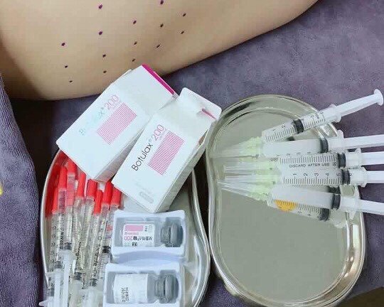Cô gái như búp bê vô hồn sau khi tiêm botox làm thon gọn mặt