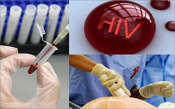 Phát hiện thêm 3.500 trường hợp nhiễm HIV trong 6 tháng đầu năm 2018