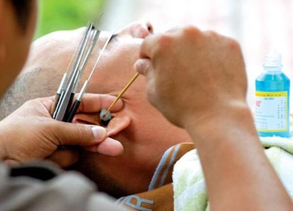 Rước bệnh vì thói quen tỉa lông mũi, lấy ráy tai ngoài hàng