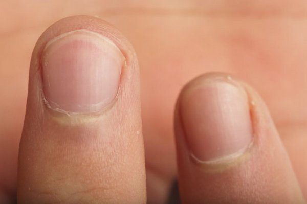 Thường xuyên cho 7 thứ quen thuộc này vào miệng, răng bạn sẽ gặp thảm họa
