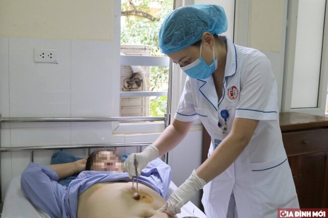 Sau khi ăn no, dạ dày người phụ nữ đột nhiên 'chạy' lên ngực