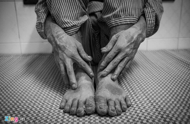 Căn bệnh khiến 2 triệu người Việt sống khốn khổ, muốn tự tử