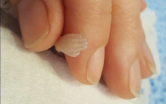 Bà mẹ chia sẻ ảnh bào thai 14 tuần tuổi vì con bị gọi là 'chất thải y tế'