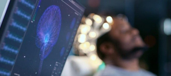 Sau khi chết, não con người có thể vẫn hoạt động?