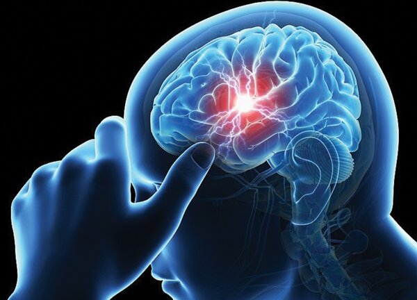 Thời tiết lạnh đột ngột, người bệnh tim mạch dễ đột quỵ bất cứ lúc nào