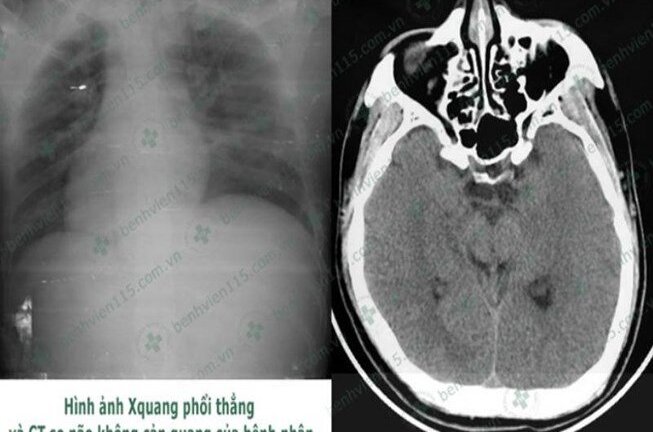 Quên ăn sáng, tài xế hôn mê sâu khi lái xe