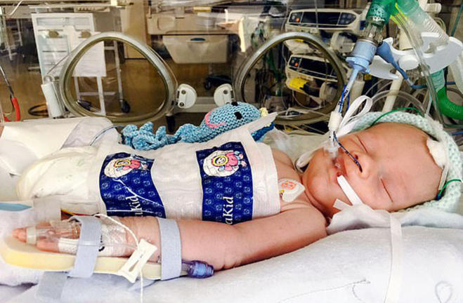 Giáng sinh đầu tiên của em bé 10 ngày tuổi sống sót kỳ diệu sau khi rút máy thở