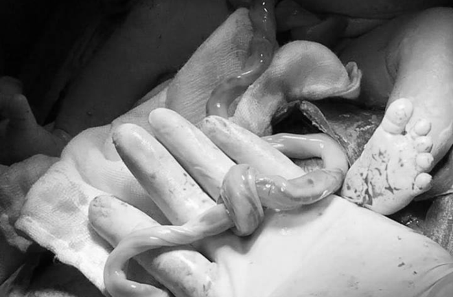 Bác sĩ bỏ ngang ca khám bệnh, lao vào phòng mổ cứu bé sơ sinh