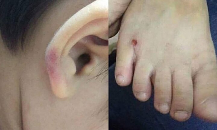 Cô giáo Hà Nội đánh con riêng của chồng nhập viện: Mẹ ruột nén đau quay clip làm bằng chứng