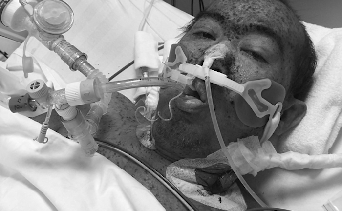 Uống liều thuốc cảm tự mua, người đàn ông bị hôn mê