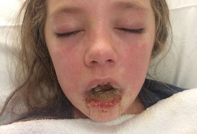 Dị ứng thuốc giảm đau, cô bé 10 tuổi tạo nên kỳ tích khi đánh thắng cả tử thần