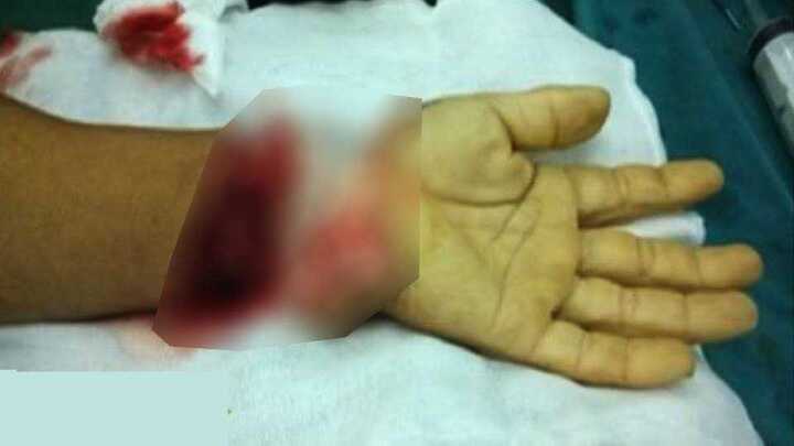 Hoảng hồn nam thanh niên tự chặt tay trong nhà tắm