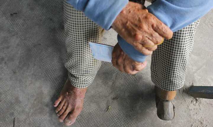 Cuộc chạy trốn số phận nghiệt ngã 30 năm của người đàn bà mắc bệnh lạ