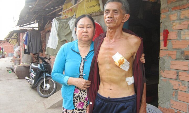 Hai thiếu niên ‘bụi đời’ vung dao sát hại xe ôm cướp tài sản