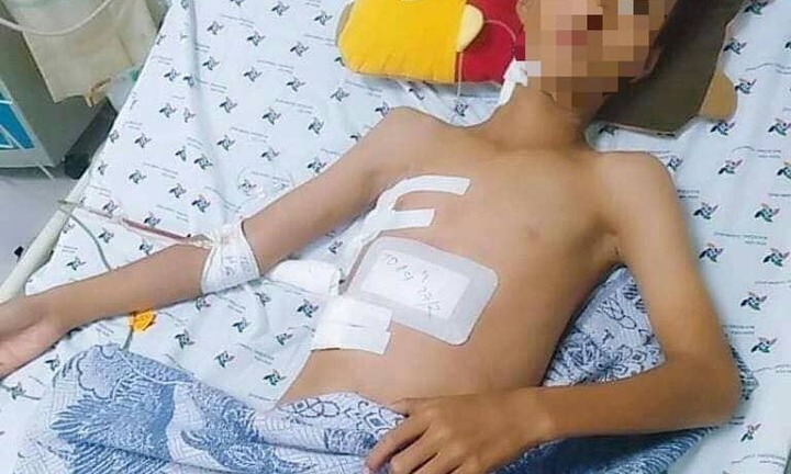 Cứu sống thiếu niên 13 tuổi bị cây sắt máy cắt lúa đâm xuyên ngực