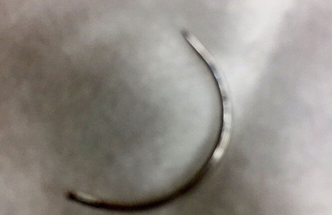 Bác sĩ để quên kim khâu trong vùng kín sản phụ ở Bình Phước