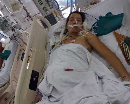 Bị tai nạn giao thông, thai phụ 7 tháng 'ngàn cân treo sợi tóc'