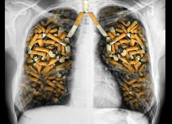 Bổ sung những thực phẩm này để chặn đứng nguy cơ mắc bệnh về phổi