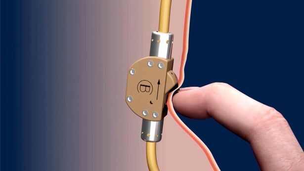 Phát hiện biện pháp ngừa thai mới ở nam giới chỉ bằng cách ấn nút