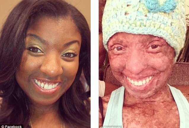 Uống thuốc động kinh, thiếu nữ suýt mất mạng