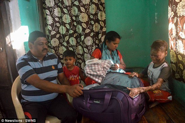 Bệnh hiếm gặp khiến cô gái như 'người rắn'